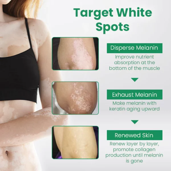 Ceoerty™ VitiligoCare Revitalizing Elixir - Image 3