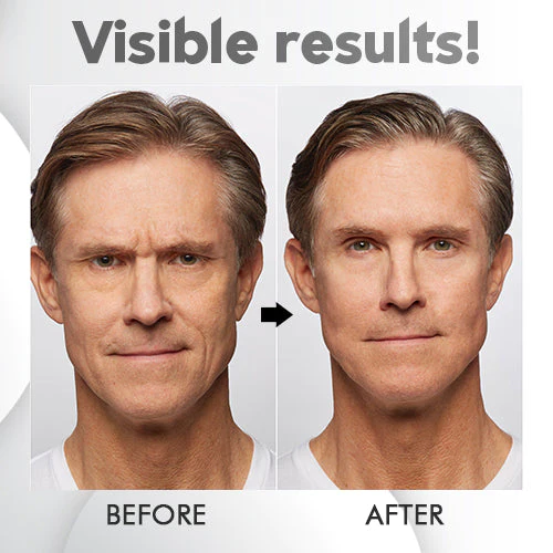 DermaX™ Perfection Serum - Image 4