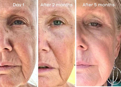 Fivfivgo™ Botox Anti-Ageing-Serum - Image 4