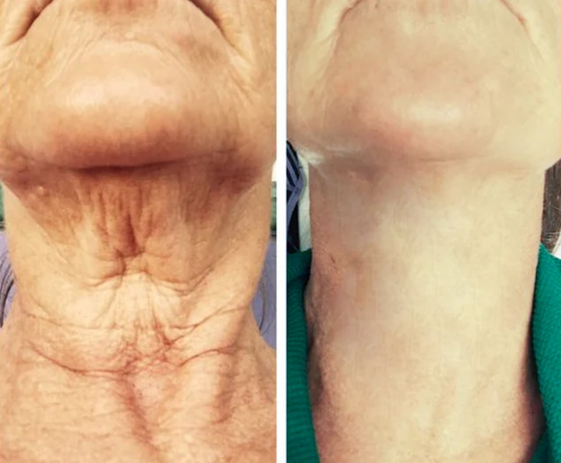 LIMETOW™ SwanPro Hydrolyzed Collagen Neck Cream - Image 5