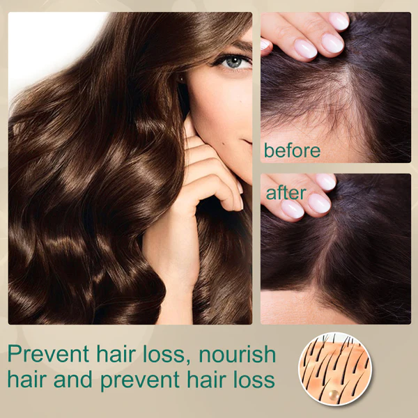 EELHOE™ Hair Boost Ginger Cream - Image 3