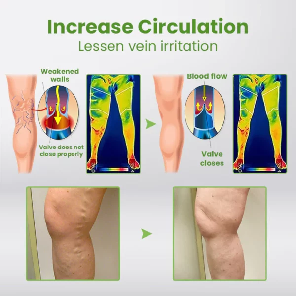 Ceoerty™ Varicose Vein PRO Xpert Spray - Image 3