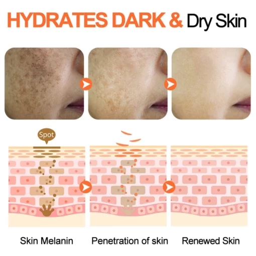 GFOUK™ Retinol Pigment Correcting Spray - Image 3