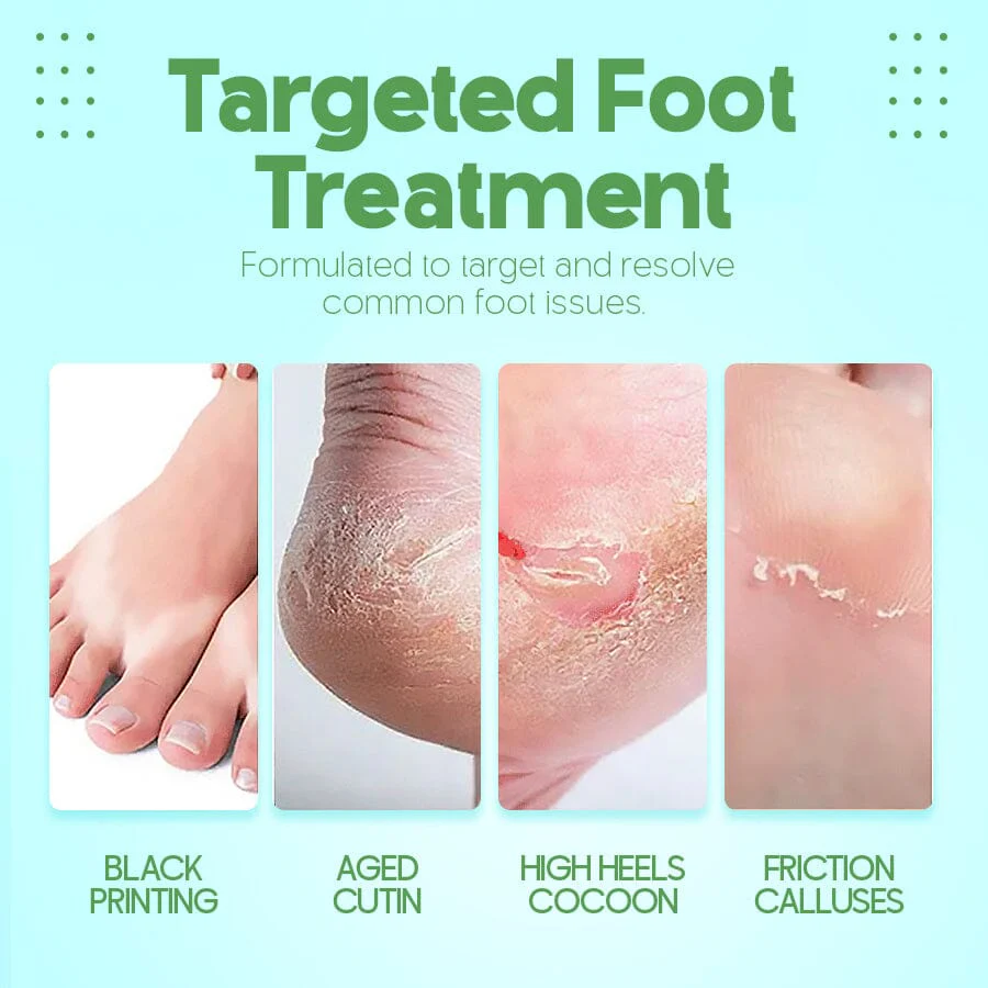 FootEase™ Tear It Off - Image 5