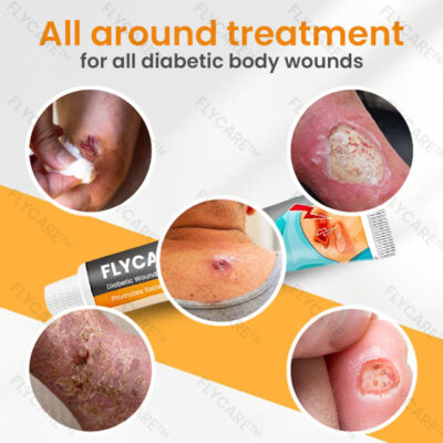 FLYCARE™ Diabetic Wounds Treatment Cream - Image 8