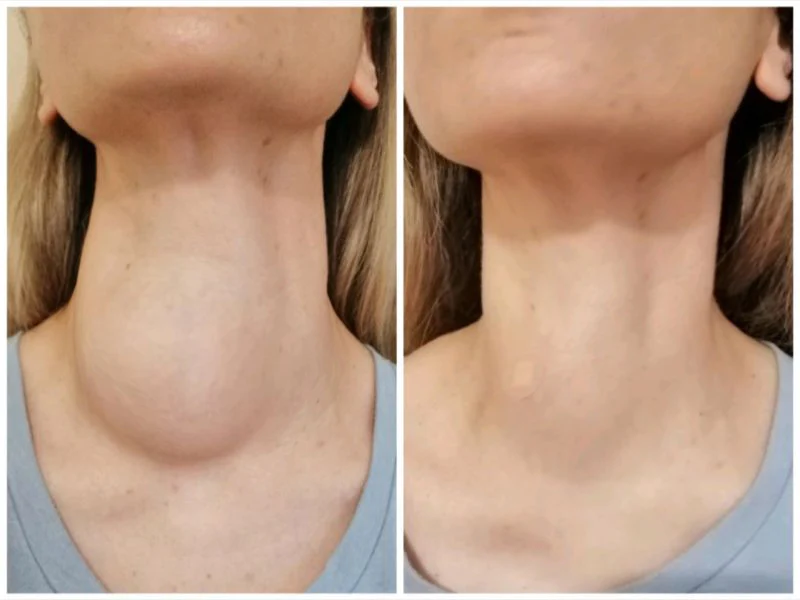 Lenreey® FlowFit Ear Patch - Image 5