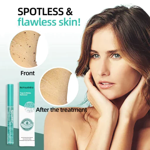 Biancat™Tags & Moles Remover - Image 3