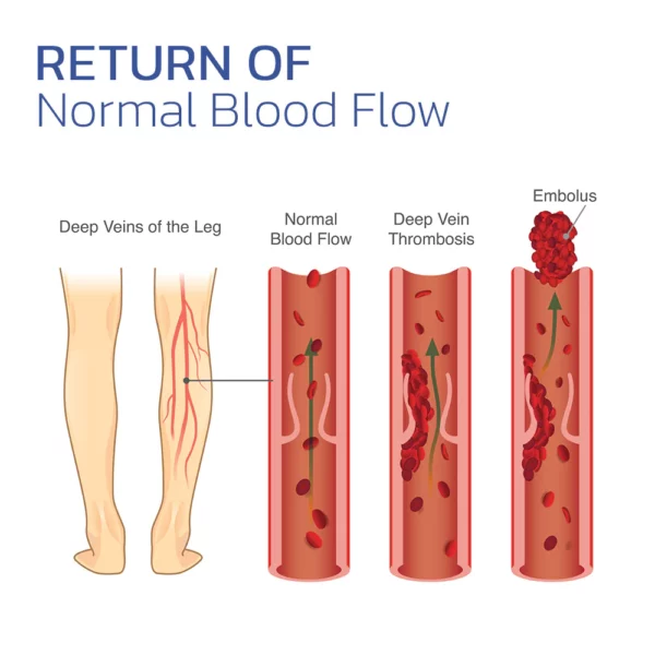 VeinesHeal Hyperthermia Socks - Image 7