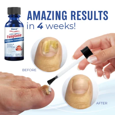 Biancat™ FungGone Herbal Paronychia Treatment Gel - Image 6