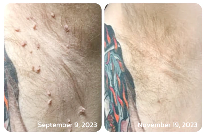 TagGone™ Bee Venom Treatment Gel - Image 8