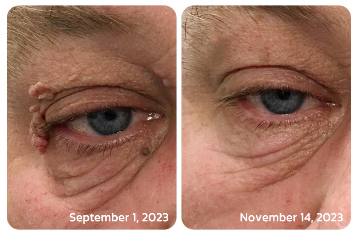 TagGone™ Bee Venom Treatment Gel - Image 7