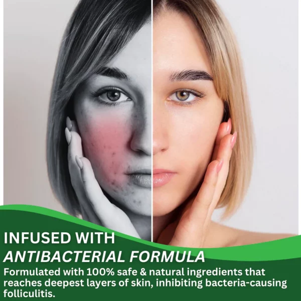 Cuzvc™ Anti-Folliculitis Balm - Image 5