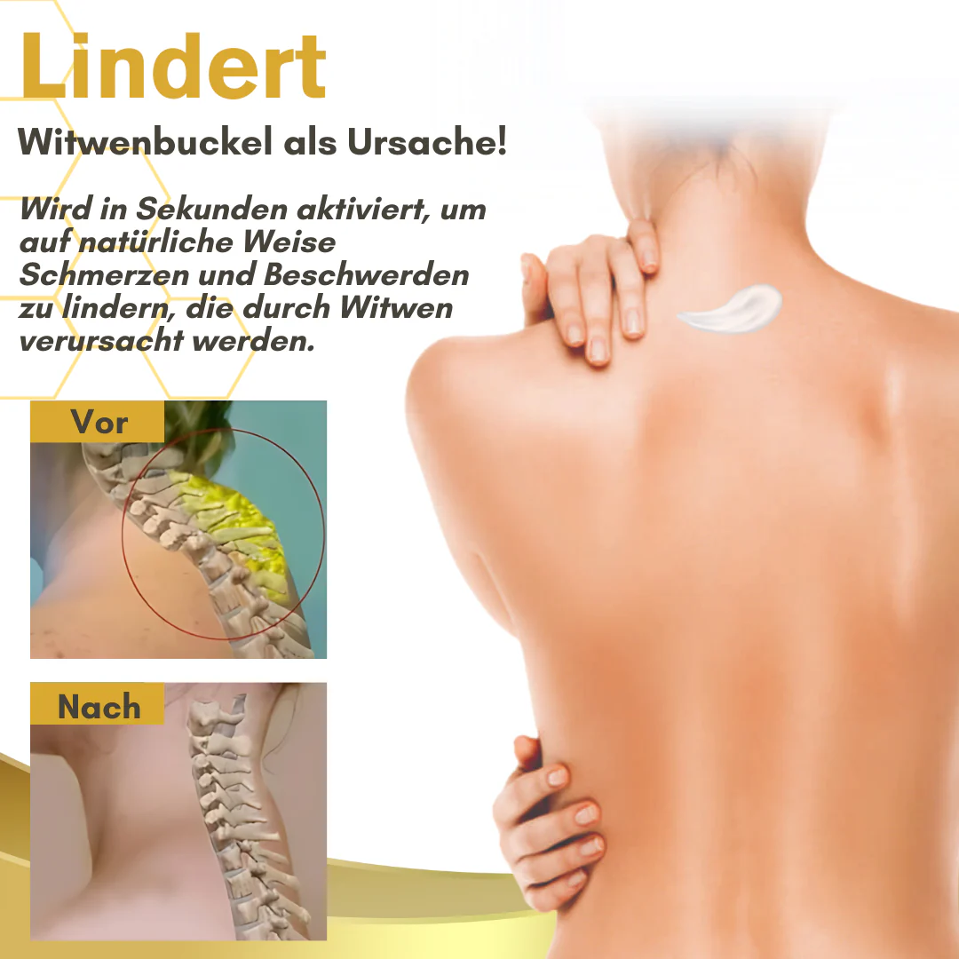 NutRelief™ Bienengift Witwe Behandlungscreme - Image 4