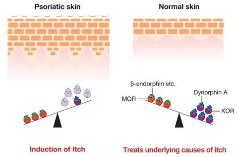 SkinMedix™ Natural Herbaceous Plants Psoriasis Cream - Image 5
