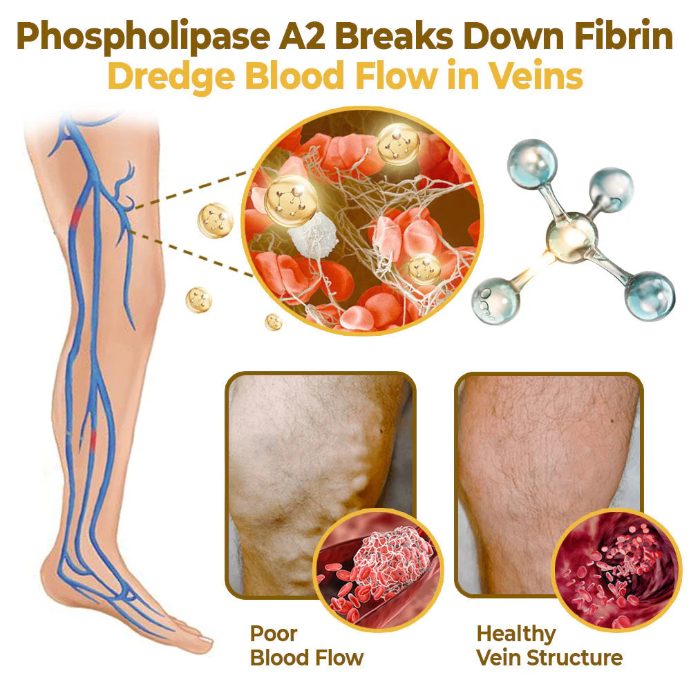 flysmus™ Varico-X Vein Dredge Bee Venom Spray - Image 4