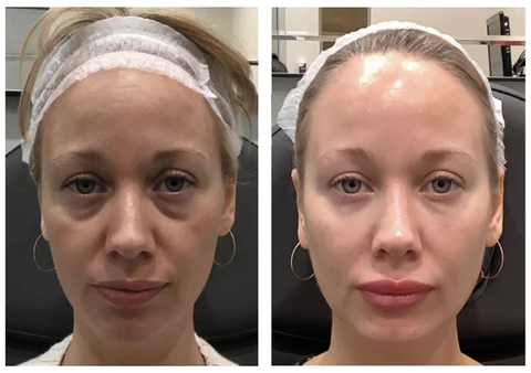 SAHARAEssence™ Brightly Ever After Serum - Image 3