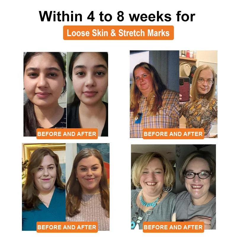 LOVILDS™ Bee Venom Lymphatic Deainage Slimming Patch - Image 4