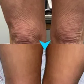 Tiworld™ SkinFirming Rejuvenating Serum - Image 5