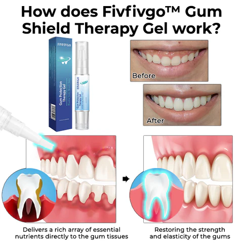 Fivfivgo™ Zahnfleischschutz-Therapiegel - Image 3