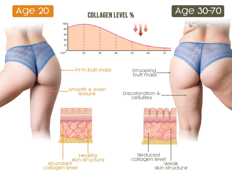 Furzero™ Brazilian Bewtie Bee Venom Body Butter - Image 4