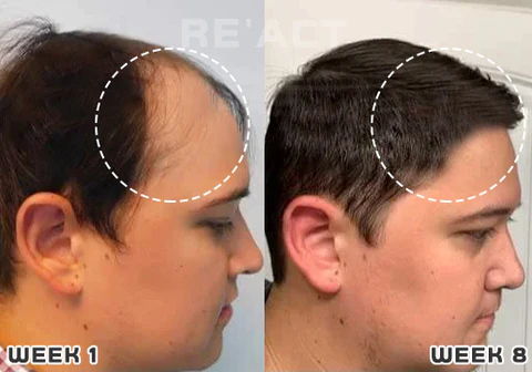 Bomgx™ Korean Dermalayr Technology Soluble Collagen Film - Image 7