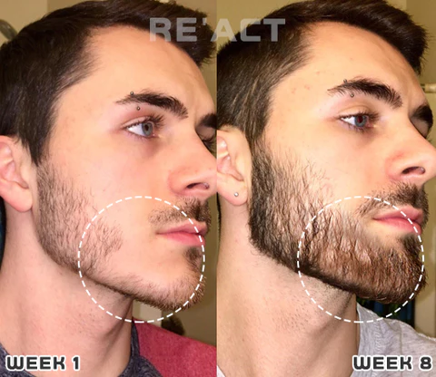 Bomgx™ Korean Dermalayr Technology Soluble Collagen Film - Image 6