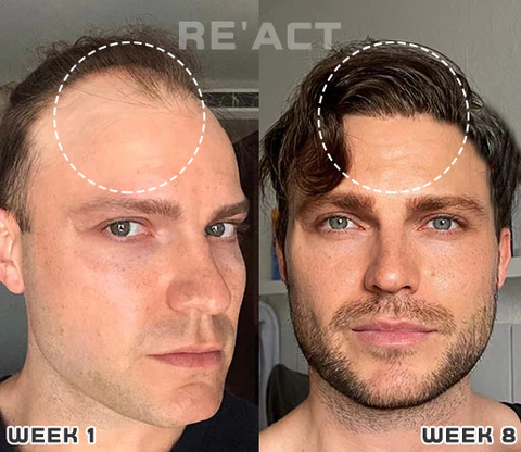 Bomgx™ Korean Dermalayr Technology Soluble Collagen Film - Image 3