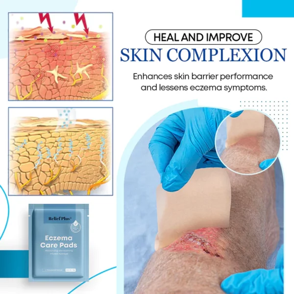 Relief Plus® Eczema Care Pads - Image 3
