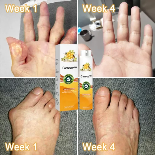 Cvreoz™ Bee Venom Pain and Bone Healing Cream - Image 7