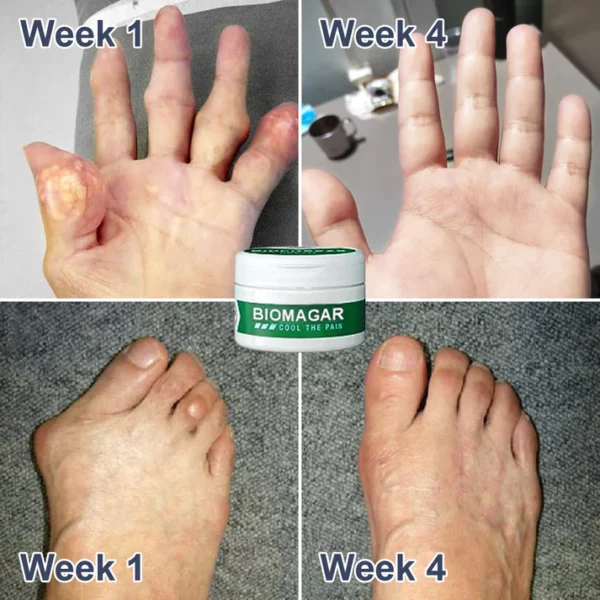 BIOMAGAR™ Bee Venom Pain and Bone Healing Cream - Image 7