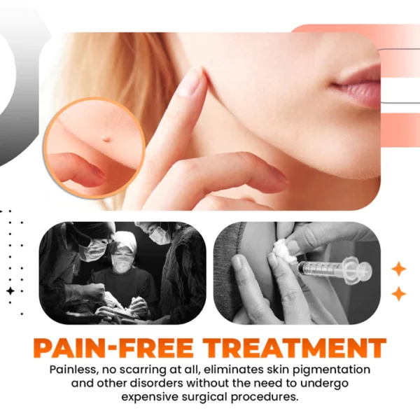 Zakdavi™️ Tags And Moles Remover - Image 7