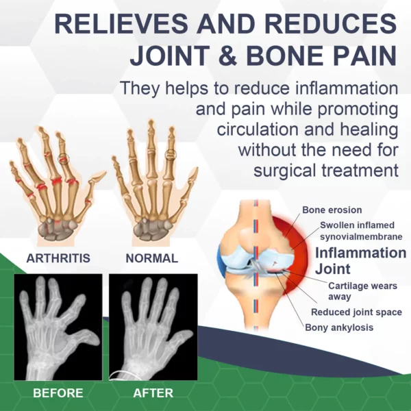 BIOMAGAR™ Bee Venom Pain and Bone Healing Cream - Image 8