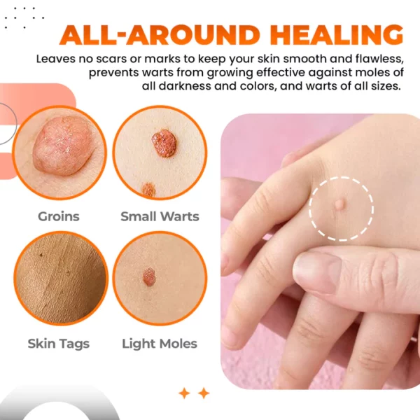 Zakdavi™️ Tags And Moles Remover - Image 8
