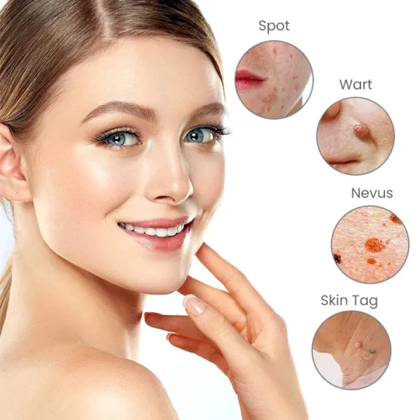 Fivfivgo™ Tragbarer Laser-Punktreinigungsstift - Image 7