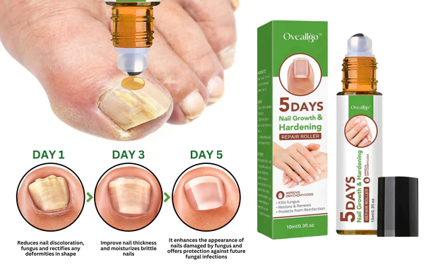Oveallgo™ 5 Days Nail Growth and Hardening Repair Roller - Image 3