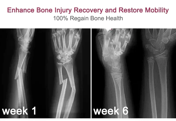 Ourlyard ™ Gelenk- und Knochentherapie-Creme - Image 6