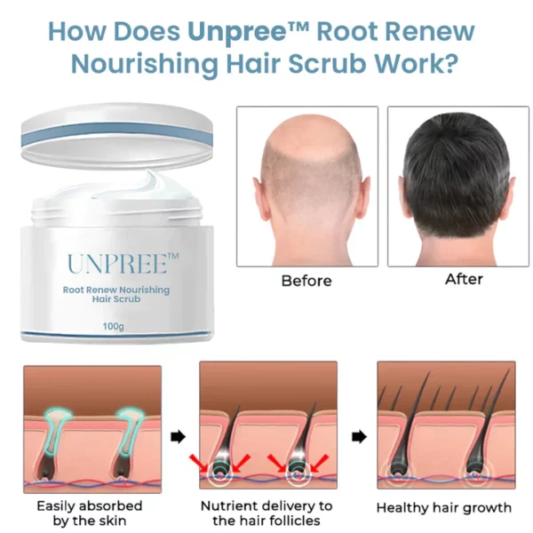 Unpree™ Root Renew Nourishing Hair Scrub - Image 4