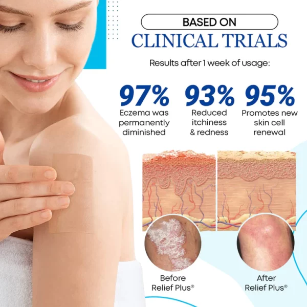 Relief Plus® Eczema Care Pads - Image 7