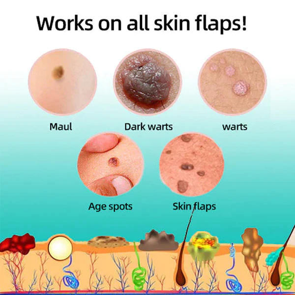 Fivfivg™ Tags & Muttermale Entferner Stift - Image 6