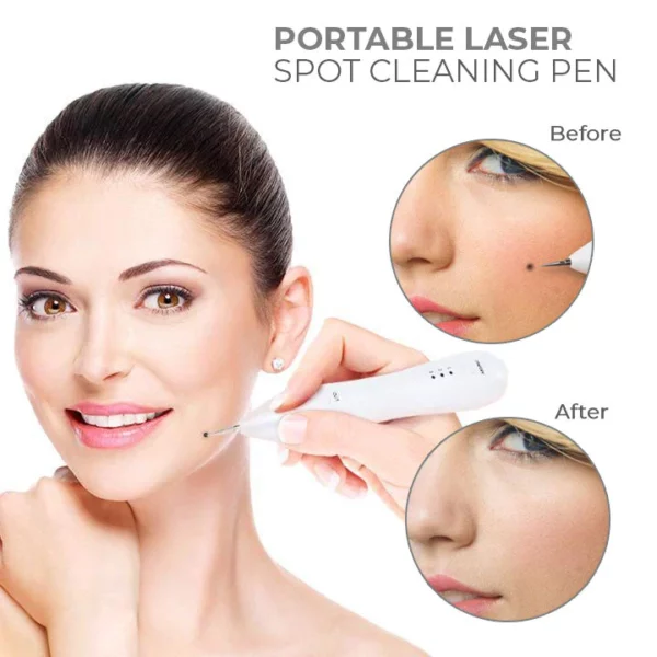 Fivfivgo™ Tragbarer Laser-Punktreinigungsstift - Image 5