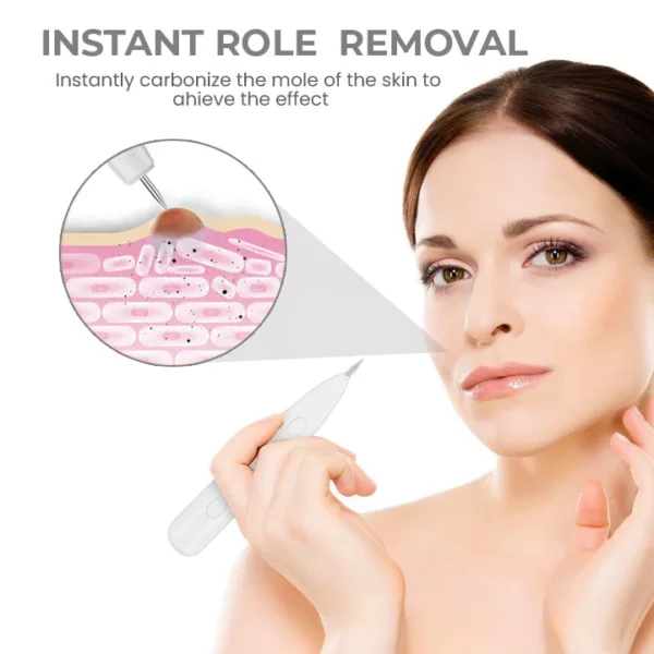 Fivfivgo™ Tragbarer Laser-Punktreinigungsstift - Image 4