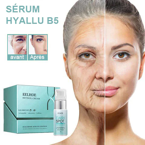 RETINOL-ANTI-AGING-CREME - Image 2