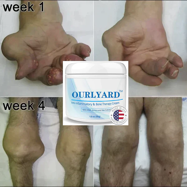 Ourlyard ™ Gelenk- und Knochentherapie-Creme - Image 5