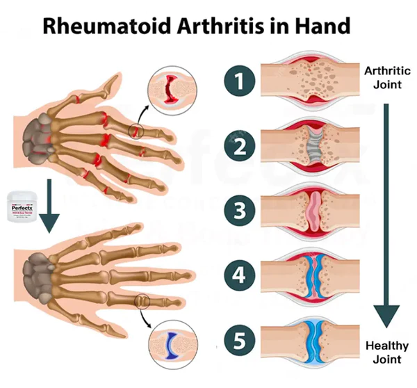 Ourlyard ™ Gelenk- und Knochentherapie-Creme - Image 4