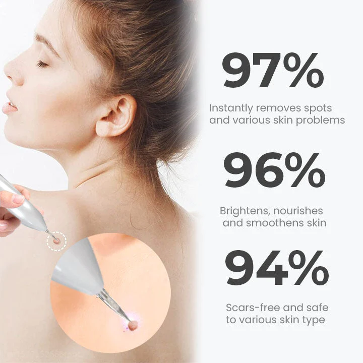 Fivfivgo™ Tragbarer Laser-Punktreinigungsstift - Image 3