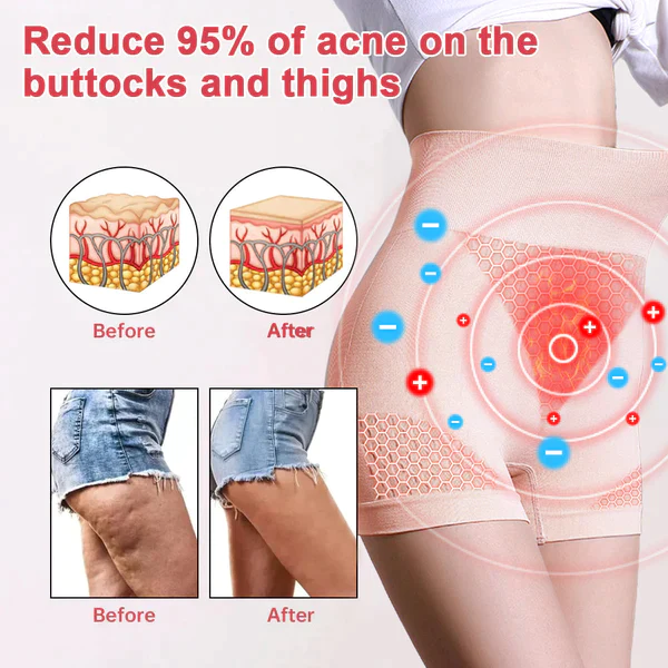 Fivfivgo™ Ferninfrarot- und Ionen-Empowerment-Shapewear - Image 5