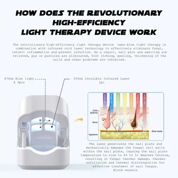 Oveallgo™ NailFungal CleaningLaser TherapeuticDevice - Image 7