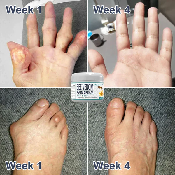 Biancat™ InflaGuard Bee Venom Joint and Bone Pain Relief Cream - Image 4