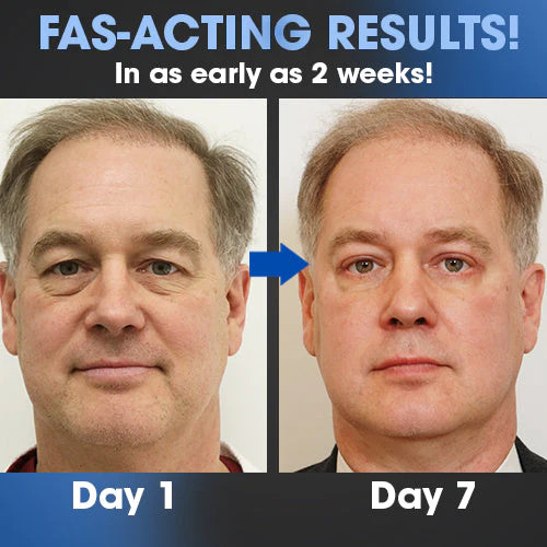 YouthRestore™ Male Peptide Eye Cream - Image 3