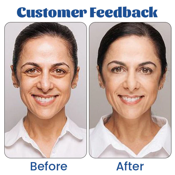 Biancat™ Retinol Renewal Eye Cream - Image 7